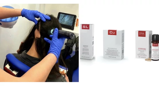 FOLTOS HAJHULLÁS OKAI ÉS HATÉKONY KEZELÉSE.